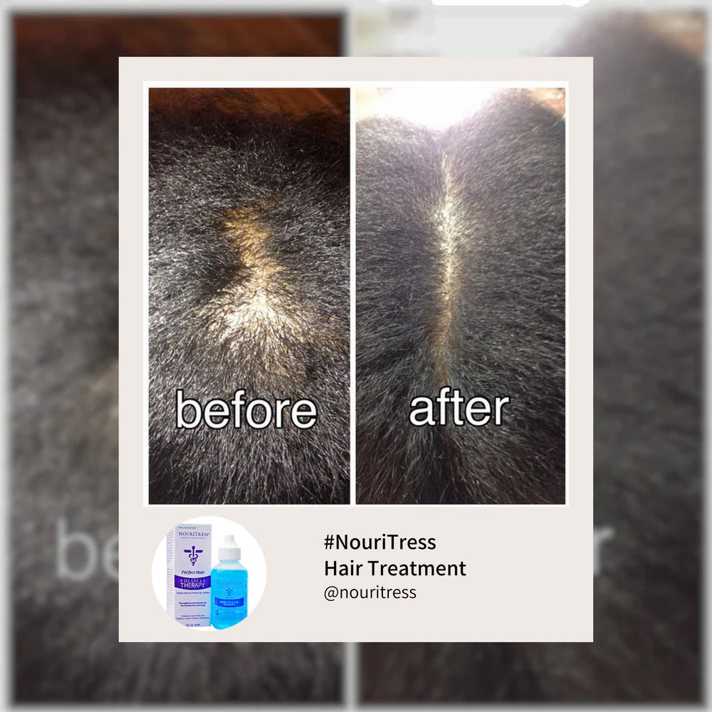 Nouritress Perfect Hair Follicle Therapy 2oz.